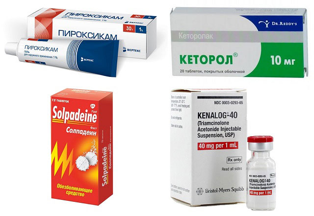 препараты Пироксикам, Кеторол, Солпадеин и Кеналог