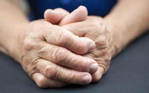 Руки человека с ревматоидным артритом