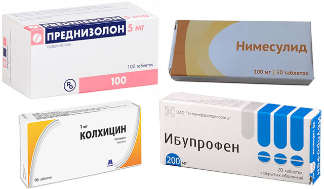 препараты Преднизолон, Нимесулид и Колхицин