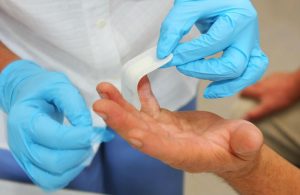 Щёлкающий палец и операция: когда необходима, риски, типы, осложнения, причины, рекомендации