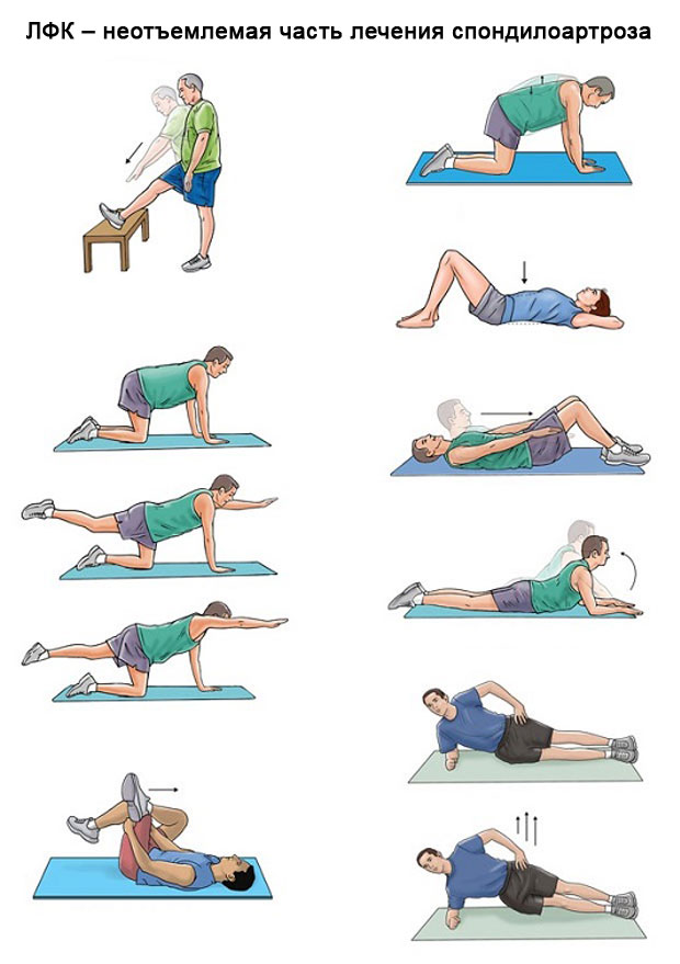 примеры упражнений лечебной физкультуры при спондилоартрозе