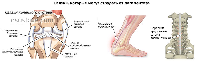 связки коленного сустава, ахиллесово сухожилие, передняя продольная связка позвоночника
