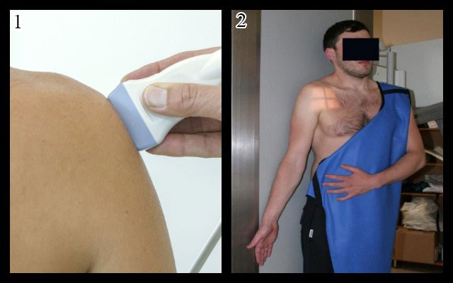 УЗИ и рентген плечевого сустава