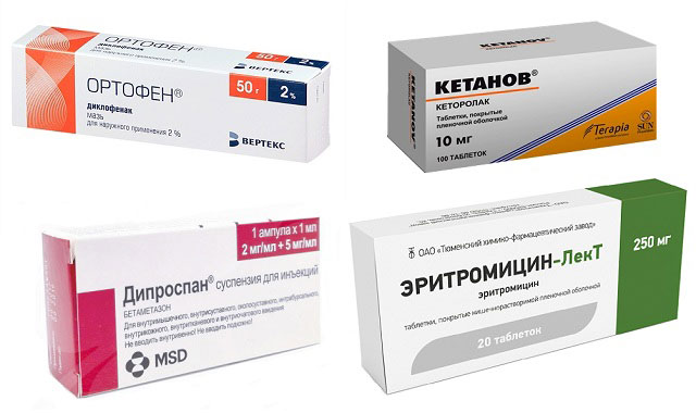 препараты Ортофен, Кетанов, Дипроспан и Эритромицин