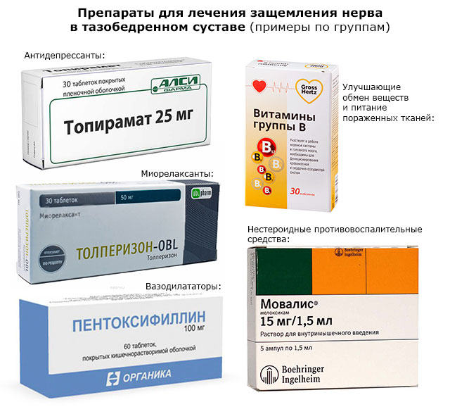 препараты топирамат, толперизон, пентоксифиллин, мовалис, витамины группы B