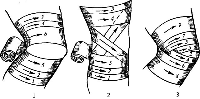 повязки на коленный сустав
