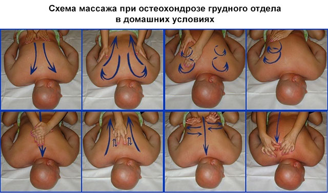 пример схемы массажа при остеохондрозе
