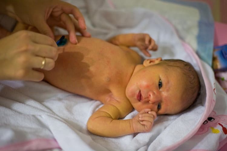 Лечение физиологической желтухи у новорожденных