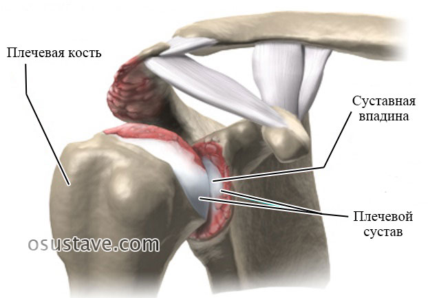 артрит плечевого сустава