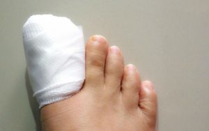 Повязка на пальце ноги после операции