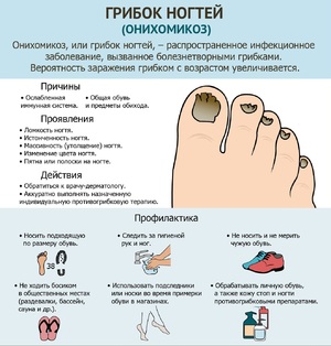Симптомы грибка ногтей ног