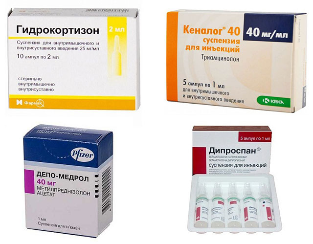 препараты Гидрокортизон, Кеналог, Метилпреднизолон, Дипроспан
