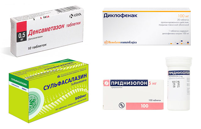 лекарственные препараты, применяемые для лечения сакроилеита