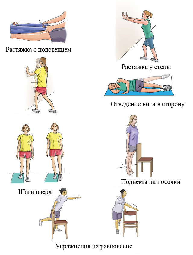 примеры упражнений лечебной физкультуры для восстановления функции ахиллова сухожилия