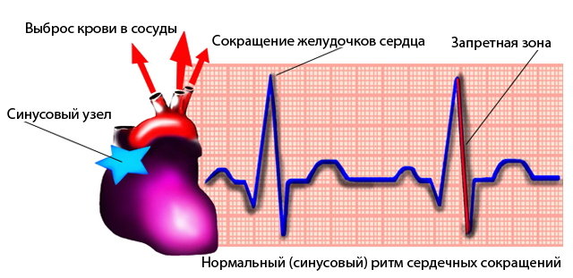 primer-kardiogrammy-zdorovogo-serdca
