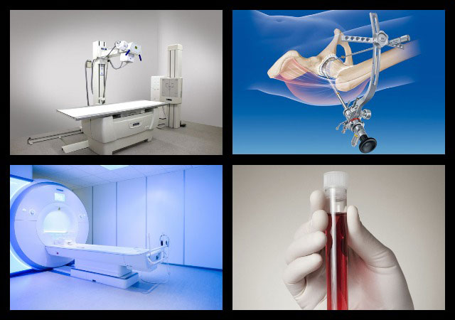 рентген, пункция сустава, МРТ и анализы крови