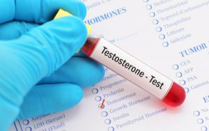 Анализ крови на тестостерон