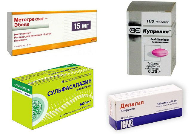 препараты Метотрексат, Д-пеницилламин, Сульфасалазин, Делагил