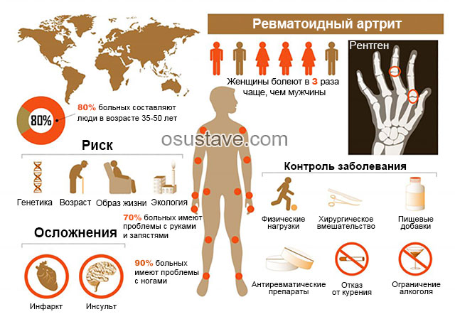 инфографика по ревматоидному артриту