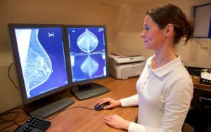 Стереотаксическая биопсия груди: как выполняется, процедура, риски, результаты, оборудование