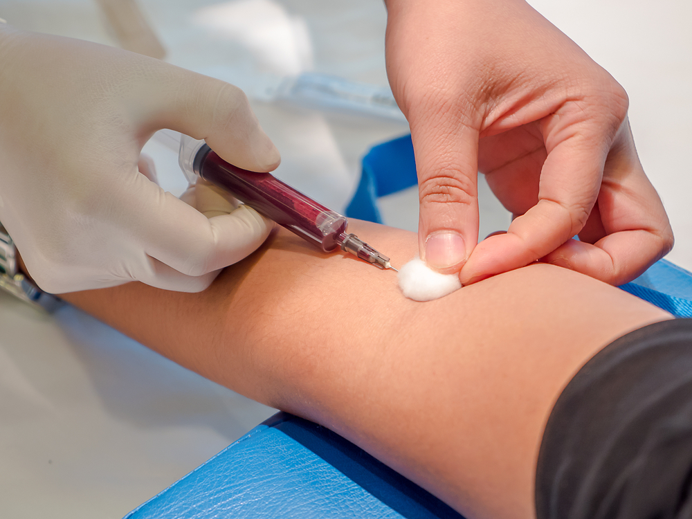 Подготовка к сдаче крови из вены на гепатит