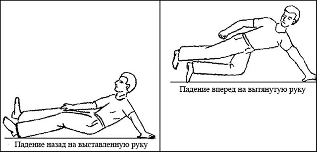 механизм вывихов плечевого сустава при падении на руку