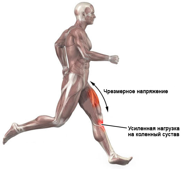 нагрузка на коленный сустав при беге