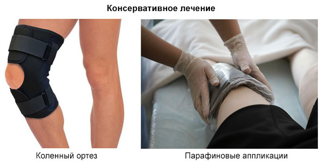 коленный ортез и парафиновые аппликации на колено