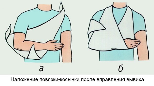 повязка-косынка на плечевой сустав