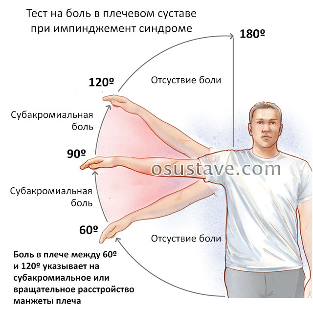 тест на боль в плечевом суставе