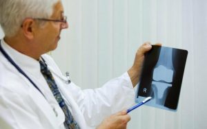 Рентгеновский снимок колена оценивает врач