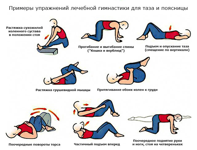 примеры упражнений лечебной гимнастики для таза и поясницы