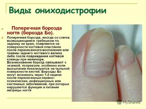 Особенности лечения ногтей
