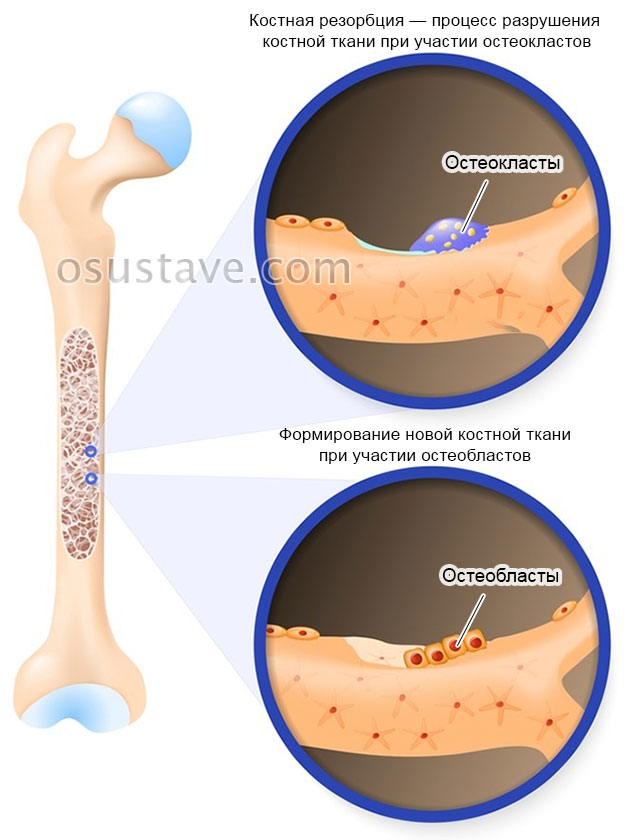 процесс обновления костной ткани