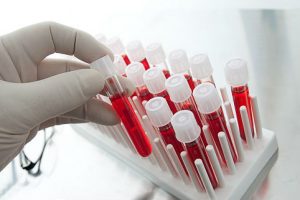 Анализ крови - как одна из диагностических процедур 