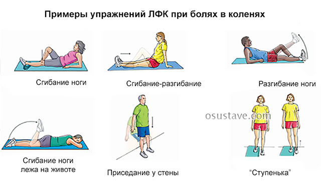 примеры упражнений ЛФК при боли в коленях