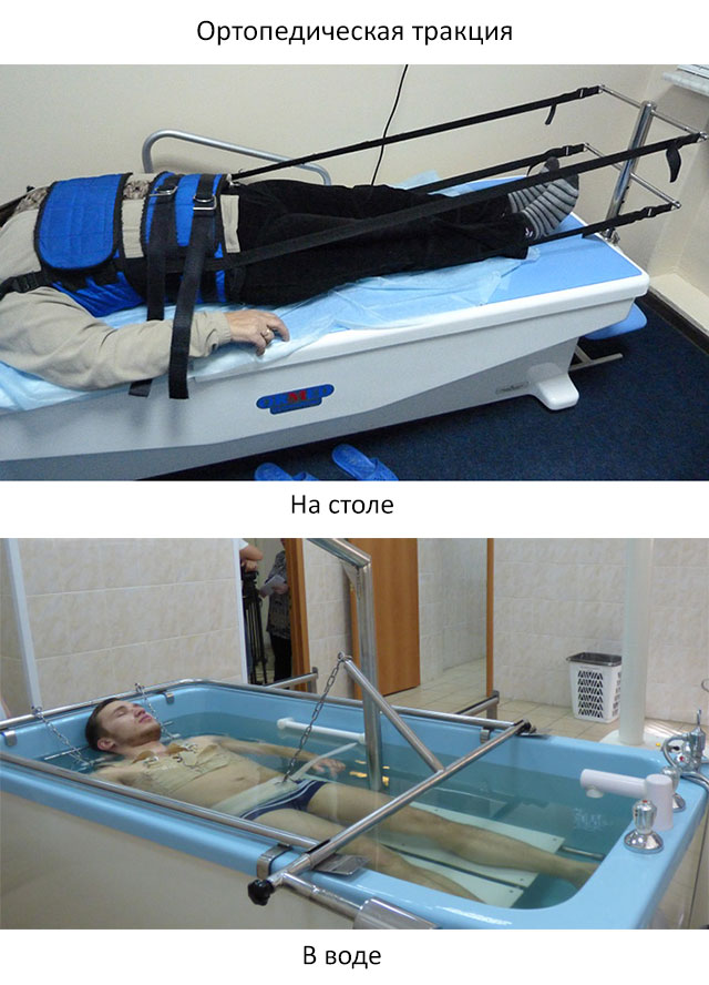 ортопедическая тракция на столе и в воде