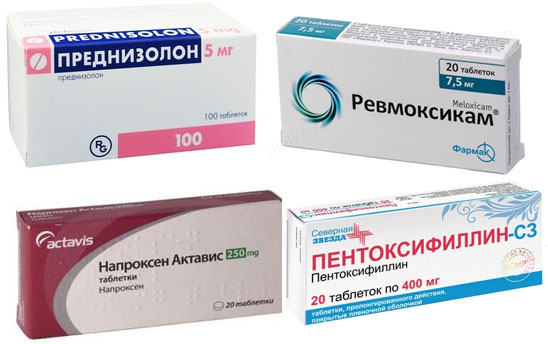 Преднизолон, Напроксен, Ревмоксикам и Пентоксифиллин