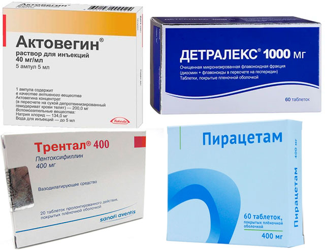 препараты Актовегин, Трентал, Детралекс и Пирацетам