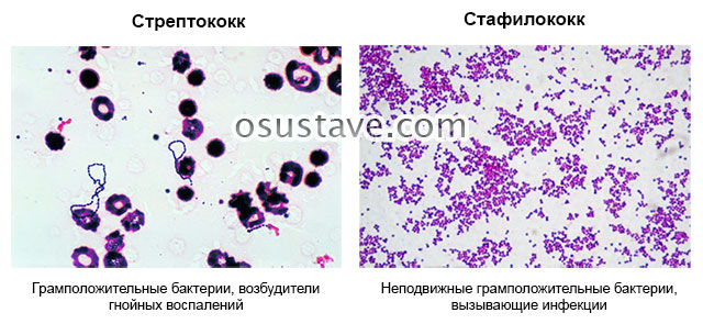 бактерии стрептококки и стафилококки