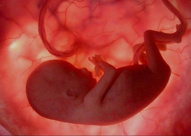 эмбрион на 20 неделе беременности