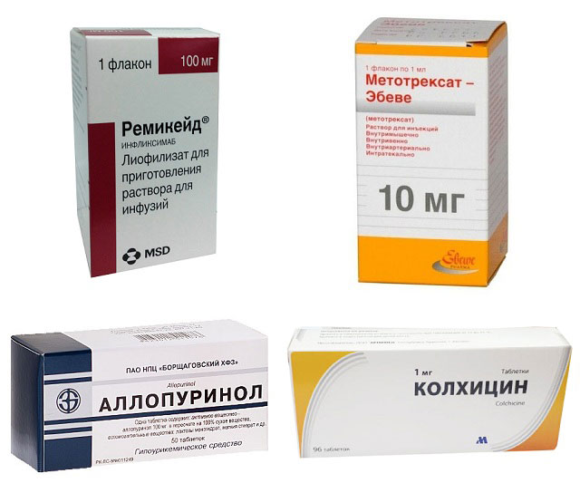 препараты Ремикейд, Метотрексат, Аллопуринол, Колхицин