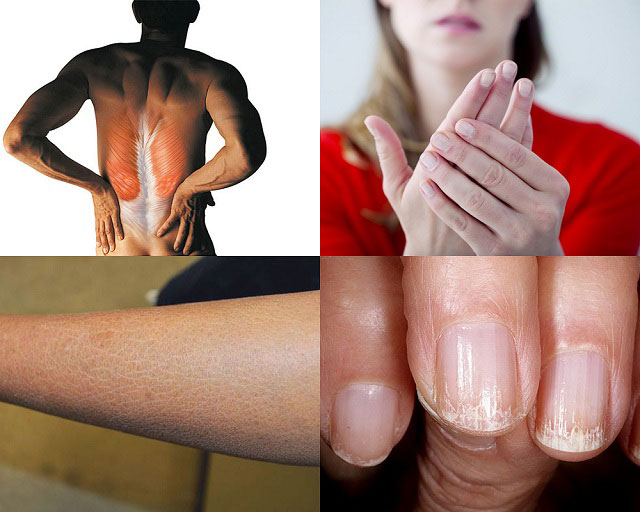напряженность мышц, холодные конечности, сухость и шелушение кожи, ломкость ногтей